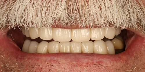 Cosmetic Dentistry 2 - After